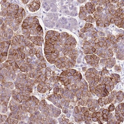 Invitrogen SLC38A5 Polyclonal Antibody 100 &mu;L; Unconjugated:Antibodies,
