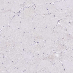 Invitrogen SLC38A5 Polyclonal Antibody 100 &mu;L; Unconjugated:Antibodies,