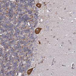 Invitrogen TPST1 Polyclonal Antibody 100 &mu;L; Unconjugated:Antibodies,