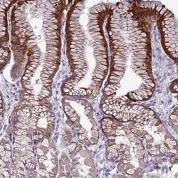 Invitrogen SLC44A3 Polyclonal Antibody 100 &mu;L; Unconjugated:Antibodies,