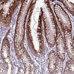 Invitrogen SLC44A3 Polyclonal Antibody 100 &mu;L; Unconjugated:Antibodies,