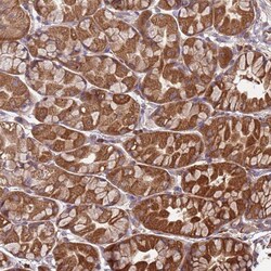 SLC44A5 Polyclonal Antibody 100 &mu;L | Buy Online | Thermo Scientific | Fisher Scientific