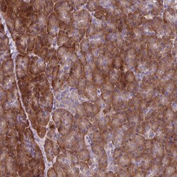 Invitrogen C20orf27 Polyclonal Antibody 100 &mu;L | Buy Online | Invitrogen&trade; | Fisher Scientific
