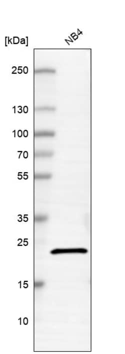 Invitrogen C20orf27 Polyclonal Antibody 100 &mu;L | Buy Online | Invitrogen&trade; | Fisher Scientific