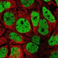 Invitrogen SH3BGRL2 Polyclonal Antibody 100 &mu;L; Unconjugated:Antibodies,