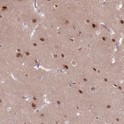 Invitrogen SH3BGRL2 Polyclonal Antibody 100 &mu;L; Unconjugated:Antibodies,
