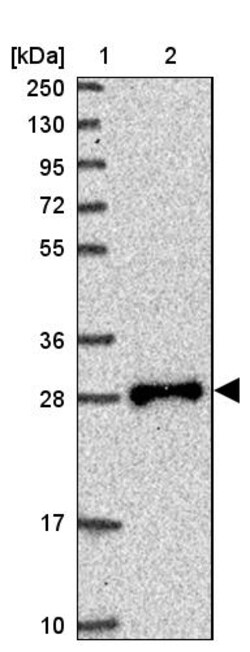 Invitrogen TPD52L2 Polyclonal Antibody 100 &mu;L; Unconjugated:Antibodies,