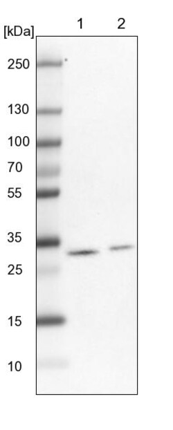 Invitrogen TPD52L2 Polyclonal Antibody 100 &mu;L; Unconjugated:Antibodies,
