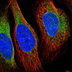 Invitrogen VRK2 Polyclonal Antibody 100 &mu;L; Unconjugated:Antibodies,