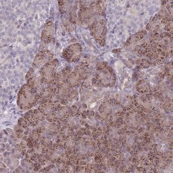 Invitrogen VRK2 Polyclonal Antibody 100 &mu;L; Unconjugated:Antibodies,