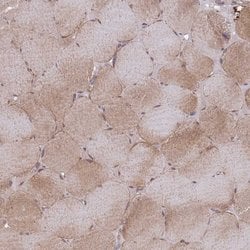 Invitrogen VRK2 Polyclonal Antibody 100 &mu;L; Unconjugated:Antibodies,