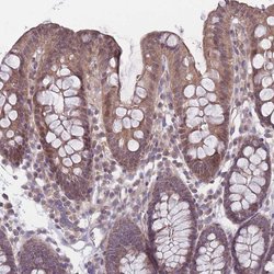 Invitrogen VRK2 Polyclonal Antibody 100 &mu;L; Unconjugated:Antibodies,