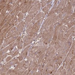 Invitrogen VRK2 Polyclonal Antibody 100 &mu;L; Unconjugated:Antibodies,