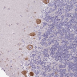 OR5L1/OR5L2 Polyclonal Antibody:Antibodies, Polyclonal