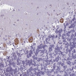 Invitrogen OR6B2 Polyclonal Antibody 100 &mu;L; Unconjugated:Antibodies,