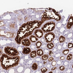 GGT2 Polyclonal Antibody:Antibodies, Polyclonal
