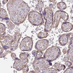 Invitrogen MYH10 Polyclonal Antibody 100 μL; Unconjugated:Antibodies,