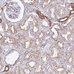 Invitrogen MYH10 Polyclonal Antibody 100 μL; Unconjugated:Antibodies,