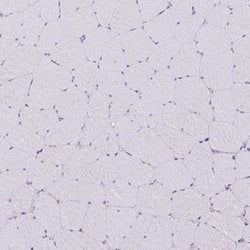 Invitrogen MYH10 Polyclonal Antibody 100 μL; Unconjugated:Antibodies,