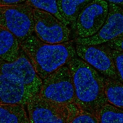 Invitrogen Cytochrome B5 Polyclonal Antibody 100 &mu;L | Buy Online | Invitrogen&trade; | Fisher Scientific