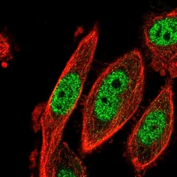 Invitrogen CDK2AP2 Polyclonal Antibody 100 &mu;L; Unconjugated:Antibodies,