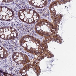 Invitrogen CDK2AP2 Polyclonal Antibody 100 &mu;L; Unconjugated:Antibodies,