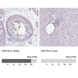 Invitrogen CEP19 Polyclonal Antibody 100 &mu;L; Unconjugated:Antibodies,