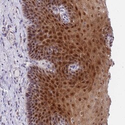 Invitrogen PLCL2 Polyclonal Antibody 100 &mu;L; Unconjugated:Antibodies,