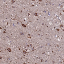 Invitrogen PYCR1 Polyclonal Antibody 100 &mu;L; Unconjugated:Antibodies,