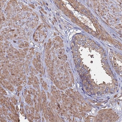 Invitrogen PYCR1 Polyclonal Antibody 100 &mu;L; Unconjugated:Antibodies,