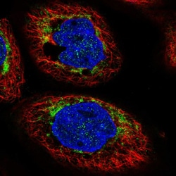 CHCHD6 Polyclonal Antibody:Antibodies, Polyclonal