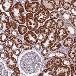CHCHD6 Polyclonal Antibody:Antibodies, Polyclonal