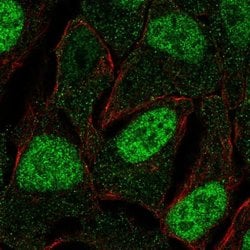 Invitrogen FAM84A Polyclonal Antibody 100 &mu;L; Unconjugated:Antibodies,