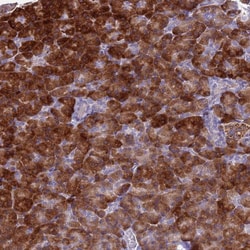 Invitrogen FAM84A Polyclonal Antibody 100 &mu;L; Unconjugated:Antibodies,