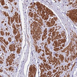Invitrogen PLEKHH1 Polyclonal Antibody 100 &mu;L; Unconjugated:Antibodies,