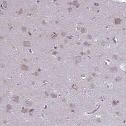 Invitrogen PET117 Polyclonal Antibody 100 &mu;L; Unconjugated:Antibodies,