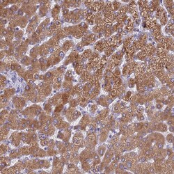 Invitrogen PET117 Polyclonal Antibody 100 &mu;L; Unconjugated:Antibodies,