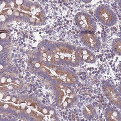 Invitrogen PET117 Polyclonal Antibody 100 &mu;L; Unconjugated:Antibodies,