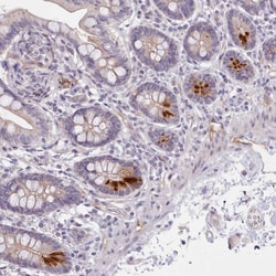 Invitrogen ZNF658 Polyclonal Antibody 100 &mu;L; Unconjugated:Antibodies,