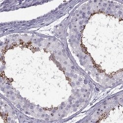 Invitrogen TBC1D3C Polyclonal Antibody 100 &mu;L; Unconjugated:Antibodies,