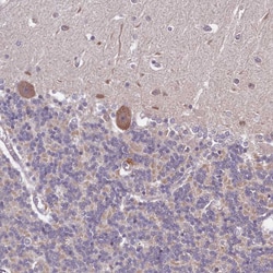 LIN37 Polyclonal Antibody:Antibodies, Polyclonal