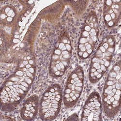 LIN37 Polyclonal Antibody:Antibodies, Polyclonal