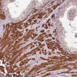 LIN37 Polyclonal Antibody:Antibodies, Polyclonal