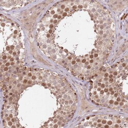 LIN37 Polyclonal Antibody:Antibodies, Polyclonal