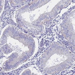 Invitrogen Alcohol Dehydrogenase 1A Polyclonal Antibody 100 &mu;L; Unconjugated:Antibodies,