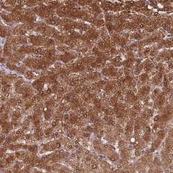 Invitrogen Alcohol Dehydrogenase 1A Polyclonal Antibody 100 &mu;L; Unconjugated:Antibodies,