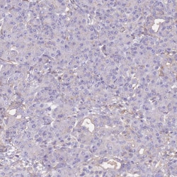 Invitrogen Alcohol Dehydrogenase 1A Polyclonal Antibody 100 &mu;L; Unconjugated:Antibodies,