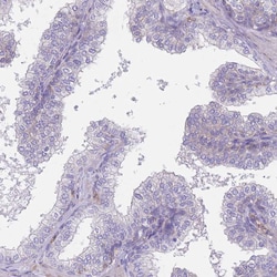 Invitrogen Alcohol Dehydrogenase 1A Polyclonal Antibody 100 &mu;L; Unconjugated:Antibodies,