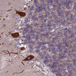 ZC3HAV1 Polyclonal Antibody:Antibodies, Polyclonal