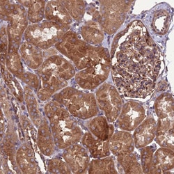 ZC3HAV1 Polyclonal Antibody:Antibodies, Polyclonal